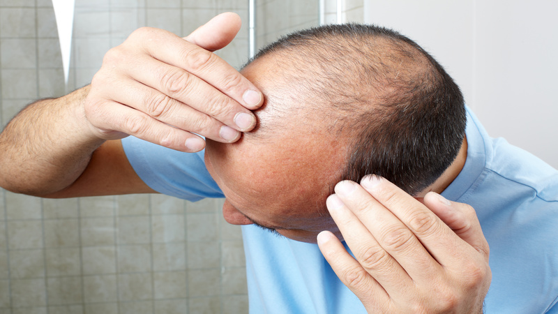 Solutions Such as Hair Loss Therapy in Austin, TX Can Be a Big Help to Many People